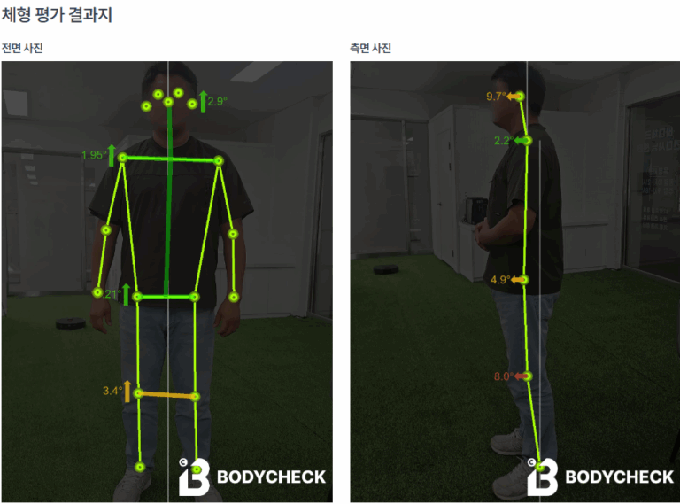 오늘도 뻐근한 목 이유가 뭐일까 사진 2장으로 원인을 알수있다면?